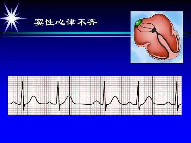 lQDPJwGCYjdhW-fNAfTNApuwEH9I1QTLYloH2jmSA7L8AA_667_500